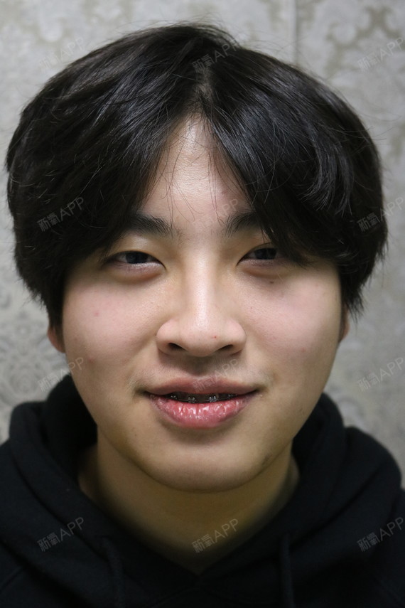 作为一个正面看脸特别圆,侧面看脸特别扁的男生,真的_圈子-新氧美容