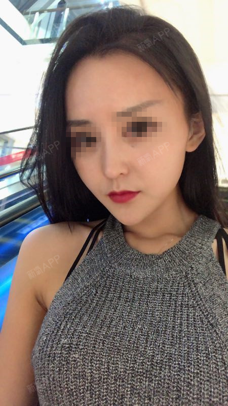氧气0aozt注射物取出第30天美丽日记