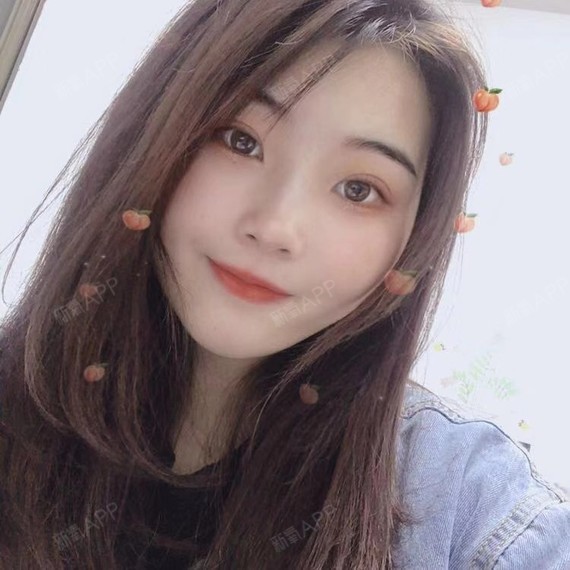 来及时更新咯,大家看下照片,已经恢复的差不多了,我_圈子-新氧美容