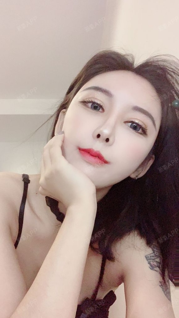 深圳嘴角上扬术好不好_效果图_氧气zpkzh嘴角上扬术术后第61天_新氧