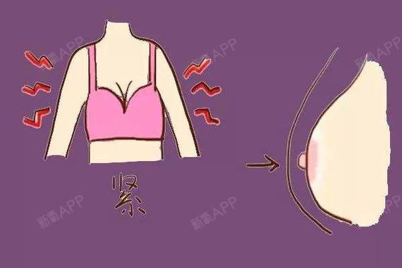 特别是发育期的女孩子穿着过于紧身的内衣,就很容易导致乳头没有发育