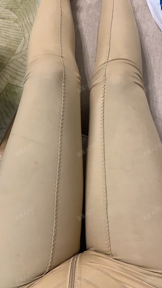 青岛华颜美射频溶脂瘦大腿术后第4天