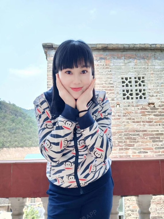 种植发际线好不好_效果图_iam奇奇种植发际线术后第109天_新氧美容