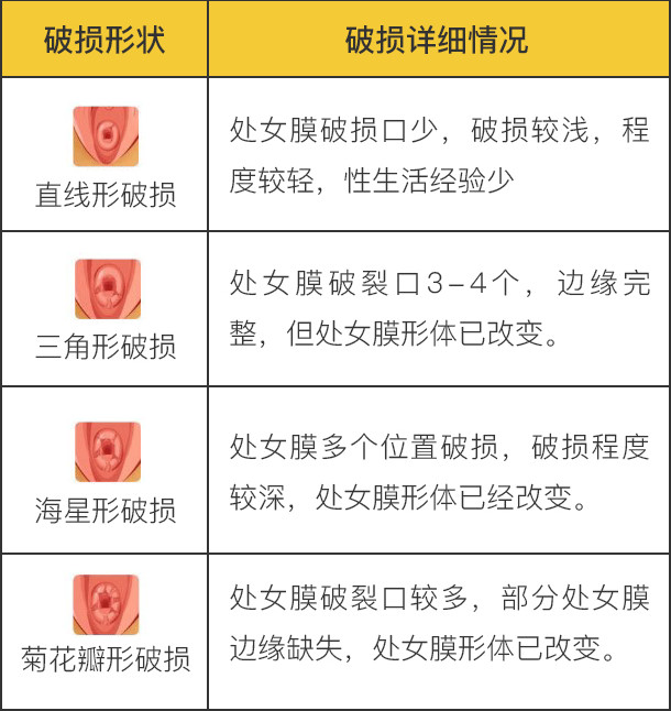修补处女膜可以去专业的医院做修补手术,这个根据自身情况判断是否