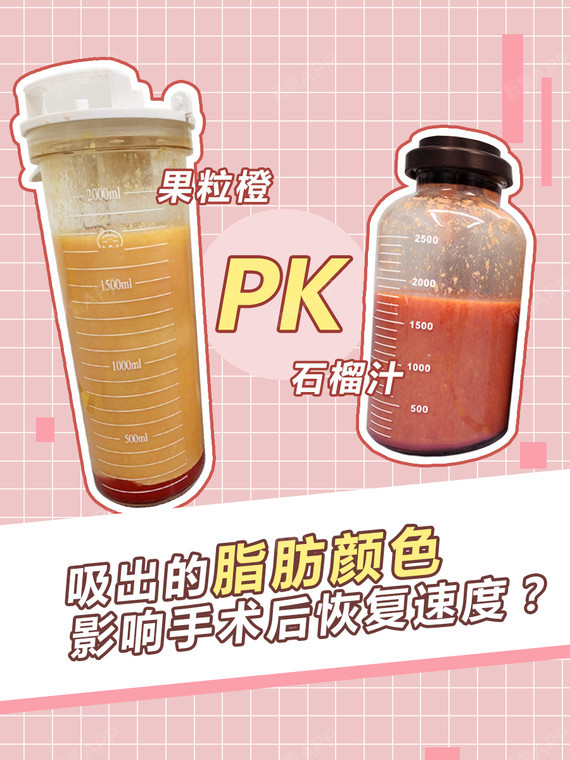 吸出的脂肪颜色影响手术后恢复速度?