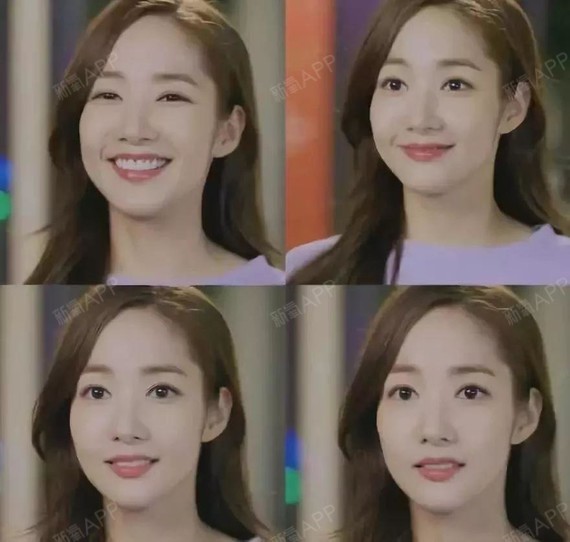 分享案例:女孩术前再三跟我强调特别喜欢朴敏英的双眼皮形状和宽度