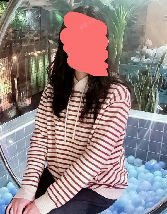 手术紧缩阴道好不好_效果图_氧气zklp0手术紧缩阴道术后第16天_新氧