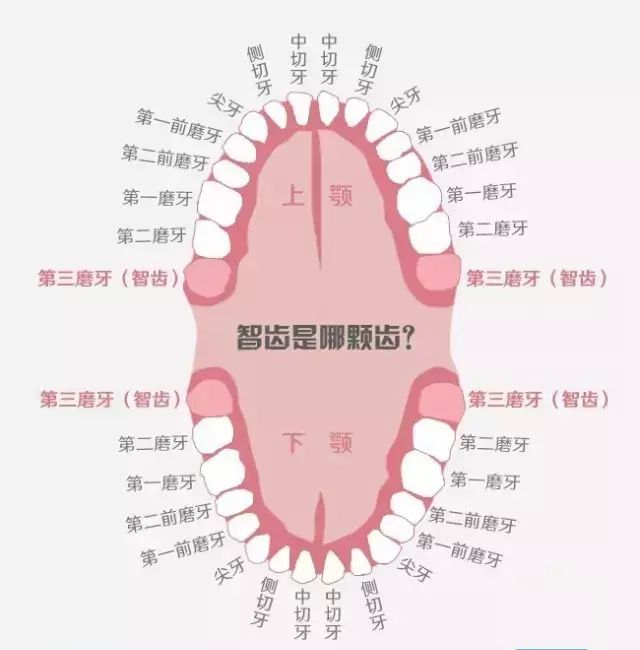 智齿是哪一颗牙齿图图片