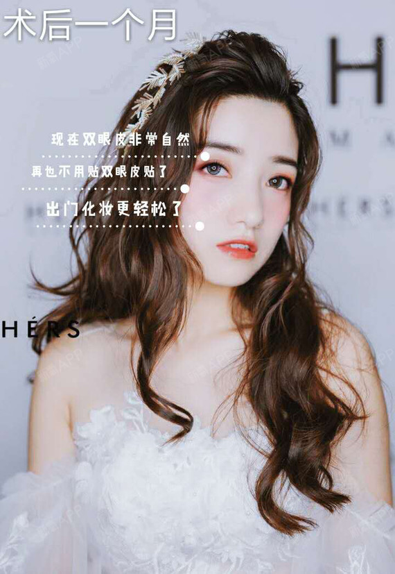 南京医美探店|九亿少女的梦不是林更新,是双眼