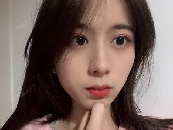 可以回家睡觉激光祛斑第54天美丽日记-新氧美