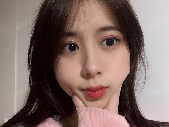 可以回家睡觉激光祛斑第54天美丽日记-新氧美