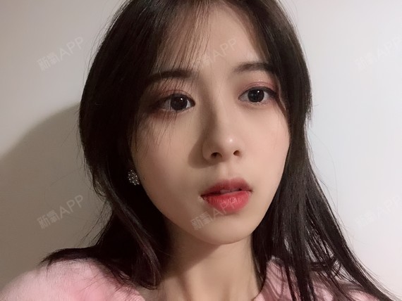 可以回家睡觉激光祛斑第54天美丽日记-新氧美