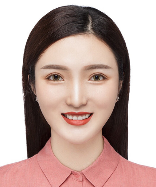 做完双眼皮后,拍证件照都美到爆炸!