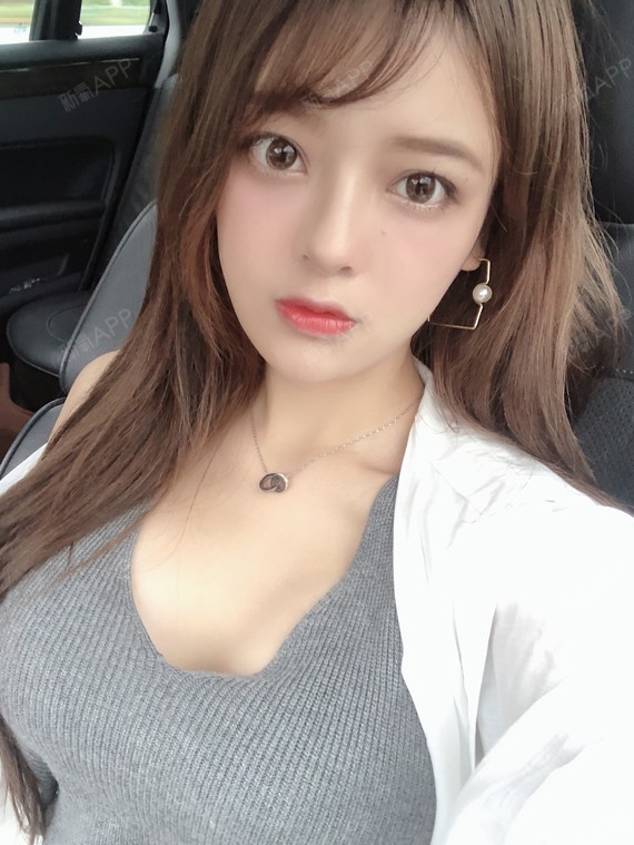 成都假体隆胸好不好_效果图_小小寒0假体隆胸术后第30天_新氧美容整形