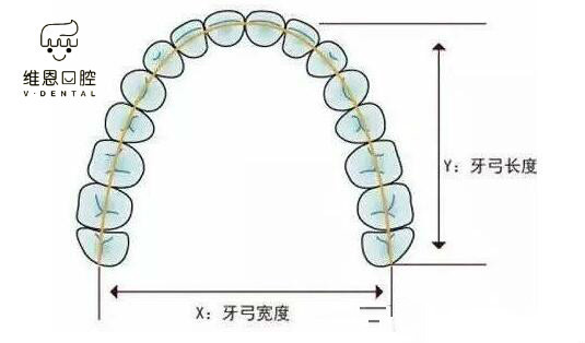 扩弓,简单的就是把你的牙弓扩大,让牙齿都有位置安放.