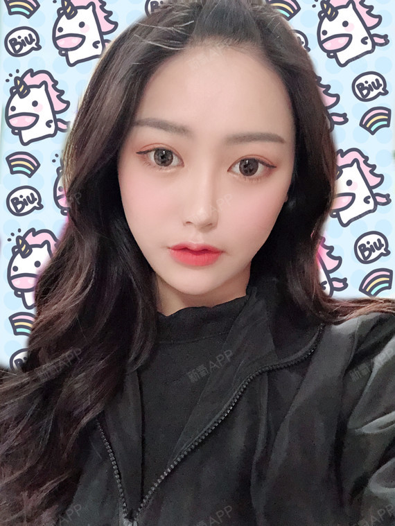 童颜针好不好_效果图_yuki小太阳童颜针术后第92天_新氧美容整形
