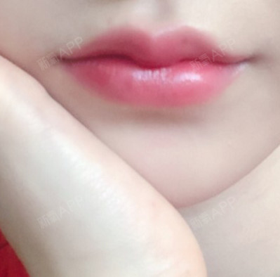 喜欢明显一些的唇珠和下唇饱满的形态
