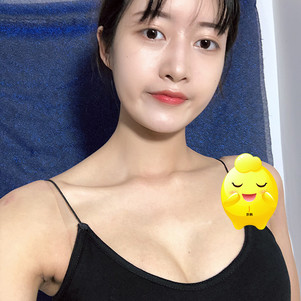 b术后当自强北京同城自体脂肪隆胸隆胸形体雕塑胸部自体脂肪填充