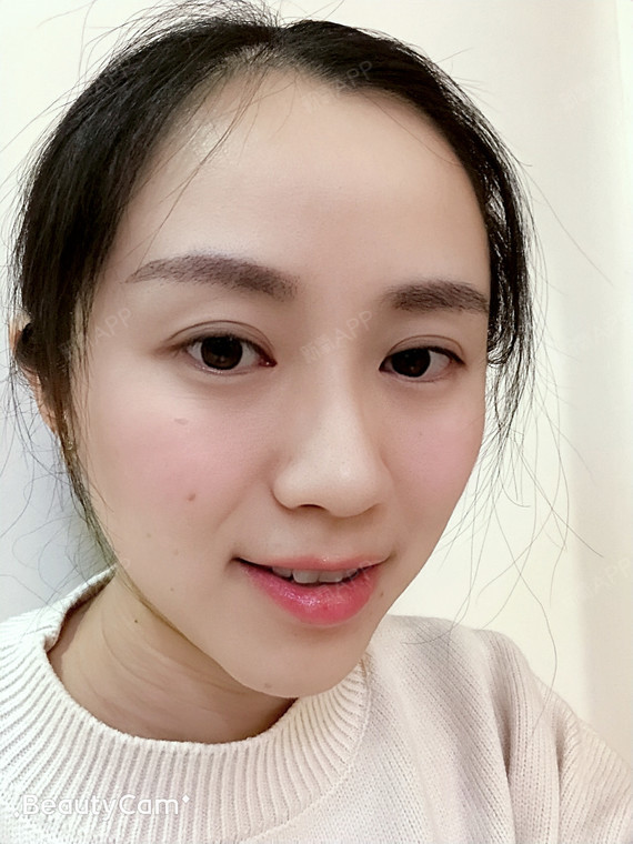 成都种植眉毛好不好_效果图_青青子衿嗄种植眉毛术后第31天_新氧美容