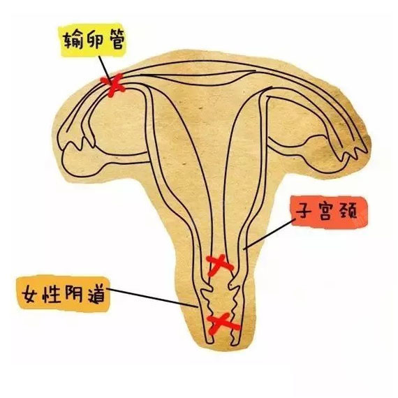 宫腔线清晰图片