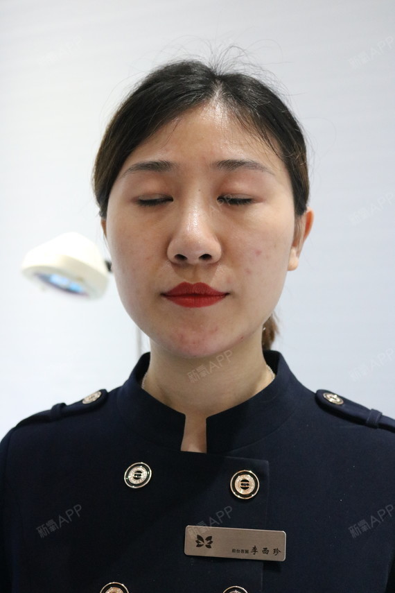 玻尿酸垫下巴好不好_效果图_你回家了玻尿酸垫下巴术后第0天_新氧美容