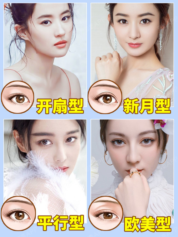 我妈妈做了十年的整形医生了,每次给姑娘们做完双眼皮,就会被问到一堆