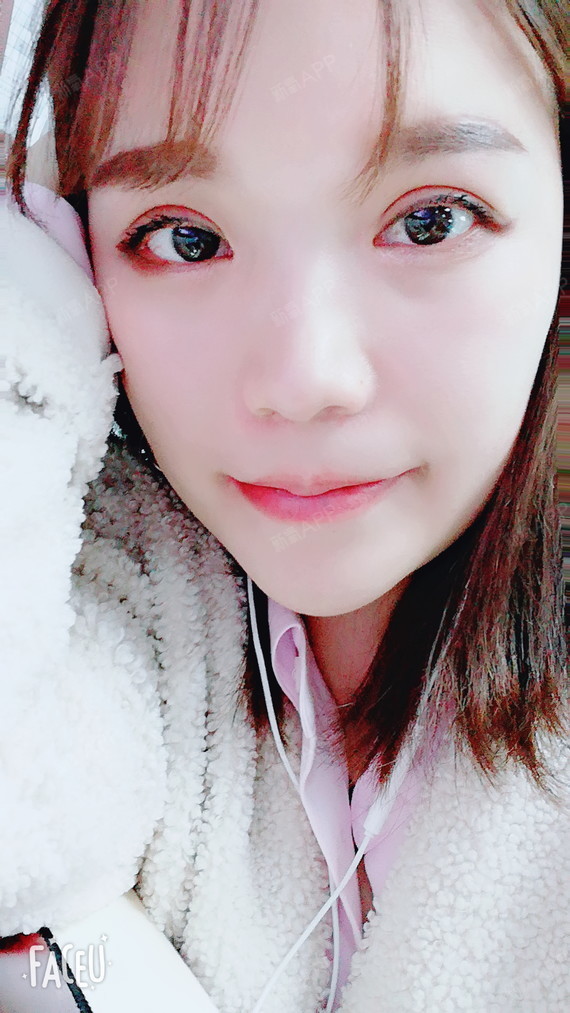 拉啦啦~~~时间总算空了来更新我的日记本了,今天是_圈子-新氧美容整形