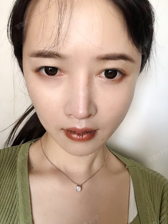 每次看到那种m唇啊,花瓣唇啊都好喜欢,嘟嘟的很可爱_圈子-新氧美容