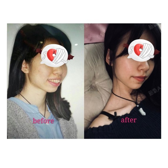 为什么你一上镜就变丑,有什么办法改善?相信很