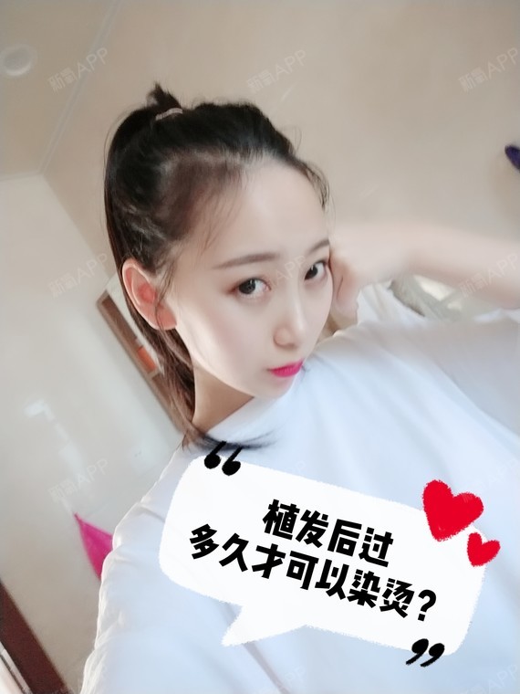 植发后过多久才可以烫染?种植头发之后在半年