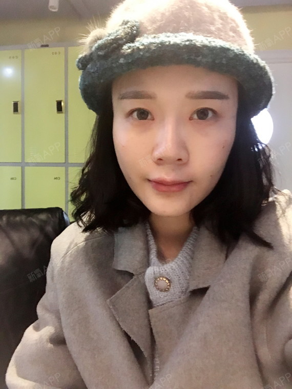 自体脂肪丰唇好不好_效果图_小啊舟舟自体脂肪丰唇术后第2天_新氧美容
