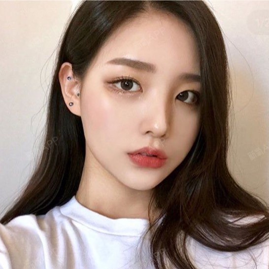 玻尿酸丰唇效果自然,比起手术丰唇,更加柔软逼真哦.