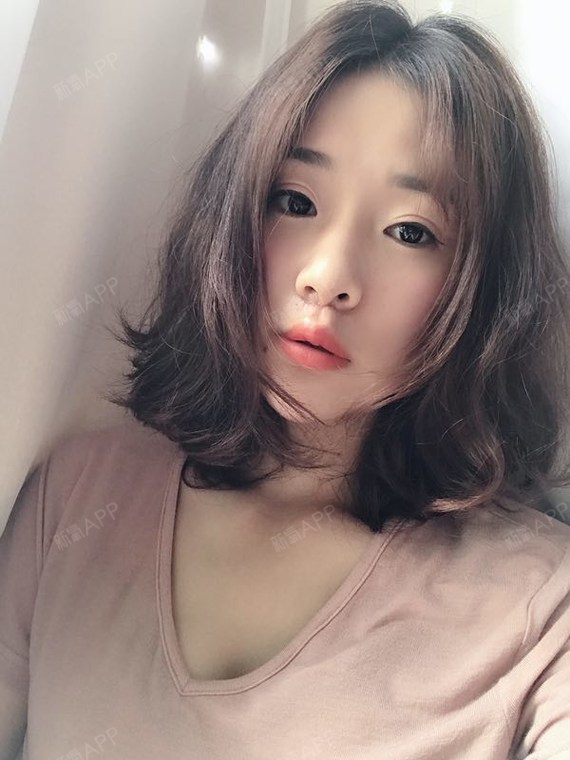 术后20天啦人中缩短的很明显对比术前照片一看那是一个天上一个地下呀