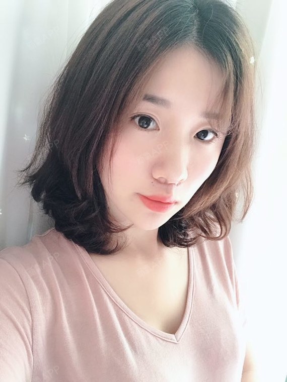 人中缩短的很明显,对比术前照片一看那_圈子-新氧美容整形