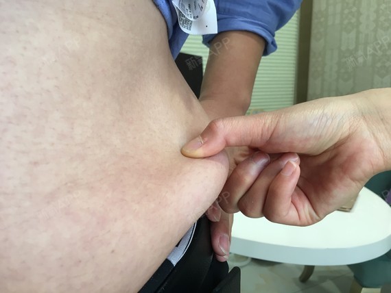 实在受不了了,系鞋带都弯不下腰啦,憋着气那种感觉