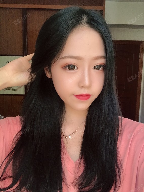 我庆幸自己当时做手术的时候选择的是正规的医院 之前 圈子 新氧美容整形