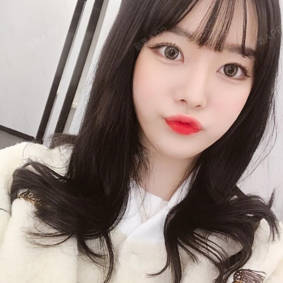 【苏州美贝尔—芭比小翘鼻】鼻部多项手术已经快两个月了_圈子-新氧