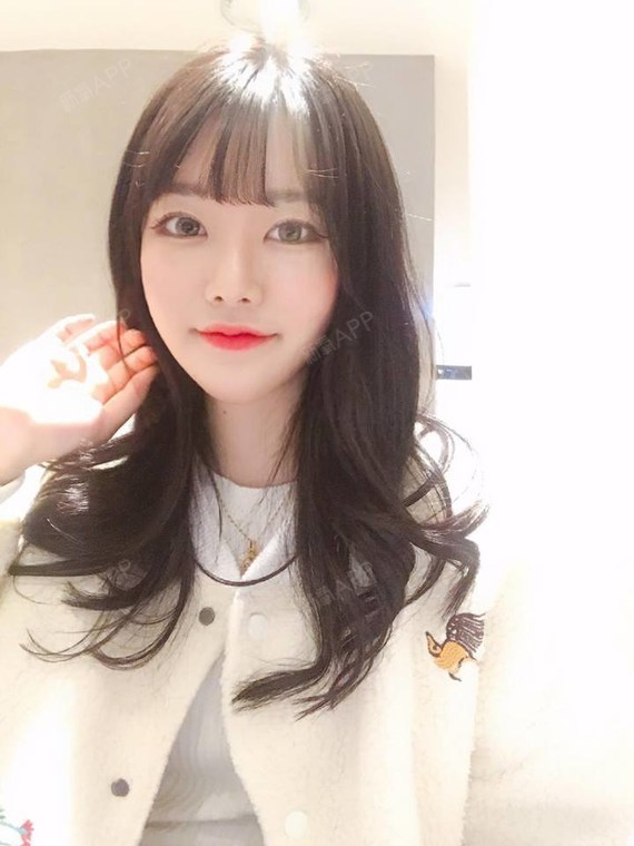 【苏州美贝尔—芭比小翘鼻】鼻部多项手术已经快两个月了_圈子-新氧