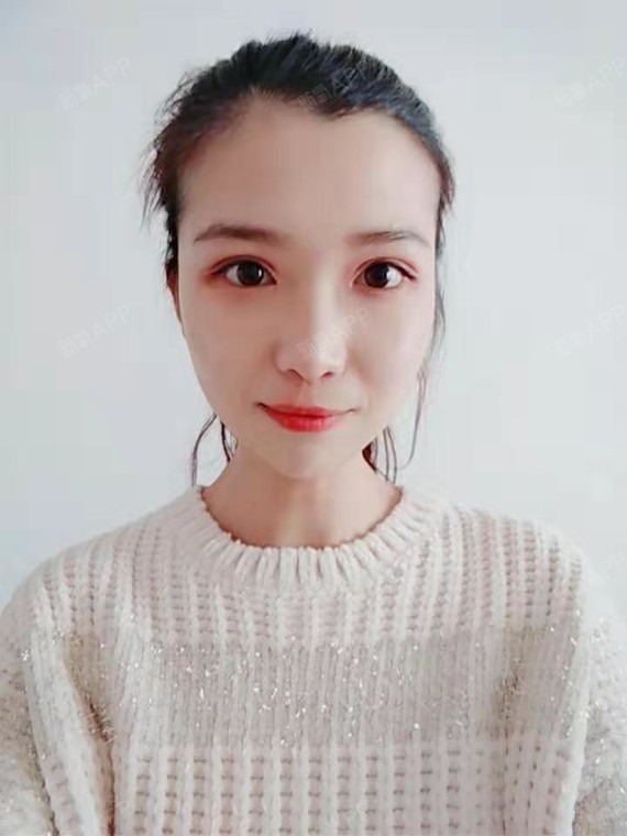 【青岛伊美尔5s重睑 超微创开眼角术后120天】术_圈子-新氧美容整形