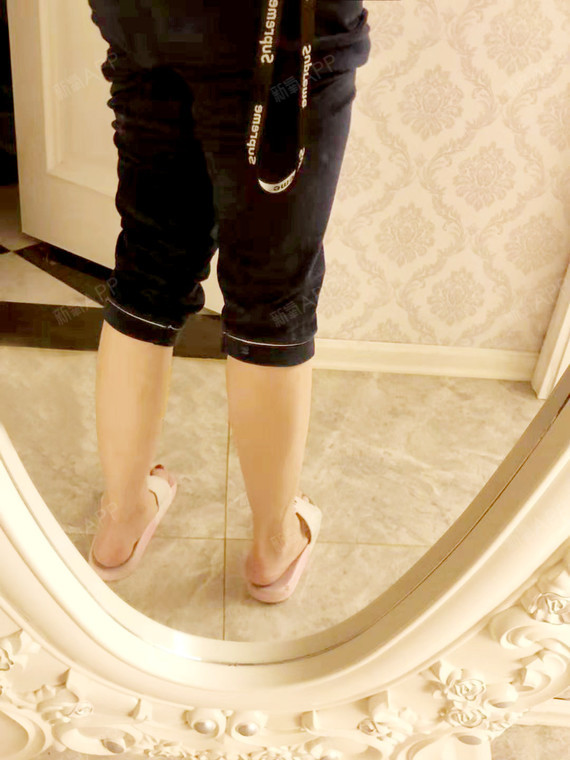 贵阳注射瘦小腿好不好_效果图_氧气_ema69f6注射瘦小腿术后第7天_新氧