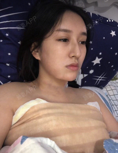 过完年我就跑来做胸部手术了,想要变成一个大胸妹子,_圈子-新氧美容