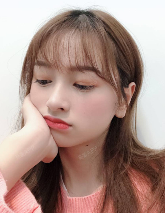 一次单纯隆鼻对颜值的提升有多大?