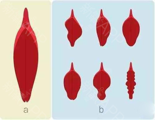 外阴的美学标准 结构完整,比例协调;小阴唇对称,菲薄,隐藏在大阴唇内