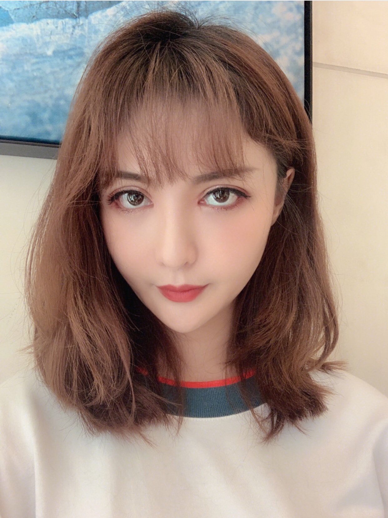 比李小璐更宽,更自然的平行双眼皮是怎么做到的?