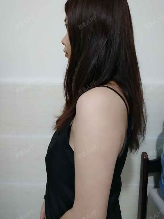 21岁了,虽然很多人胸部还是平原,但我,恰恰是最尴_圈子-新氧美容整形