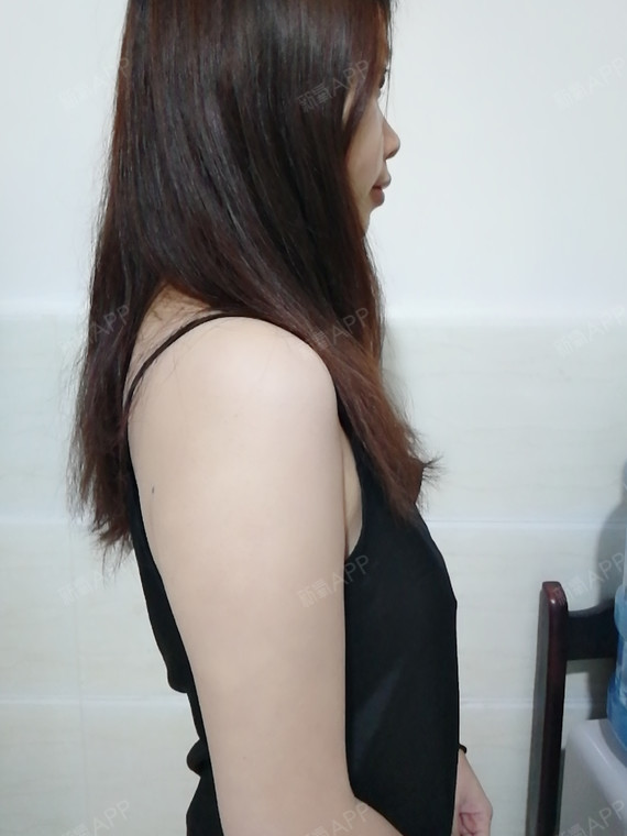 21岁了,虽然很多人胸部还是平原,但我,恰恰是最尴_圈子-新氧美容整形