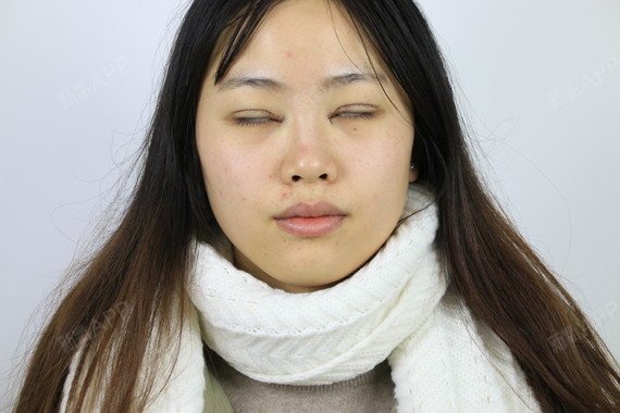 极致美容整形怎么样可靠吗（极致美容整形怎么样可靠吗安全吗） 极致美容整形怎么样可靠吗（极致美容整形怎么样可靠吗安全吗） 整形美容