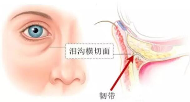 长期的黑眼圈 早睡也没用 用了眼霜效 新氧美容整形