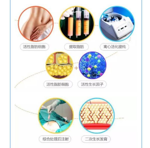 怎么办今天填充第12天了依旧肿的跟猴子 新氧美容整形