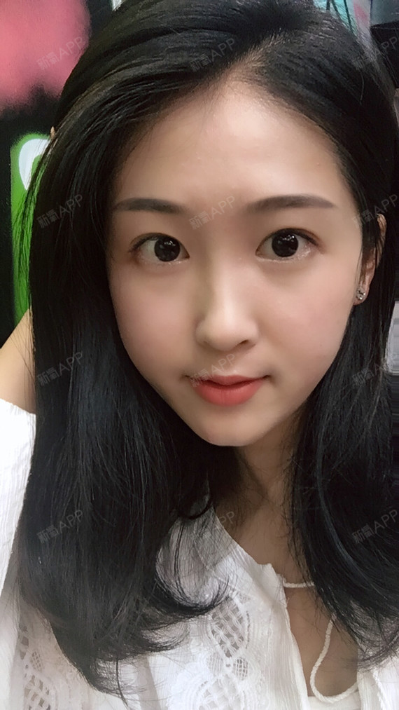 南京医美探店|自体脂肪让你Gat高级脸!出门在